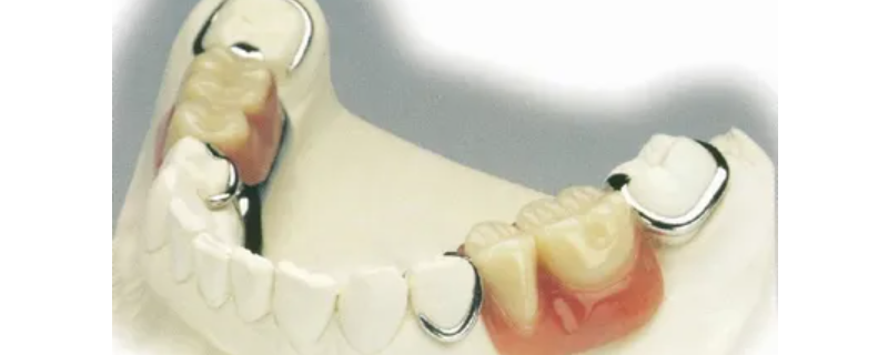 活动假牙咀嚼力能恢复多少 活动假牙要多久才适应